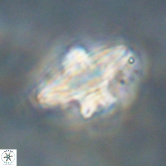 Discoaster diastypus VR 29109