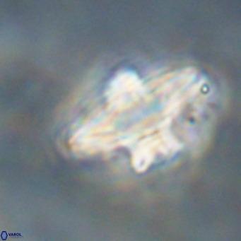 Discoaster diastypus VR 29110