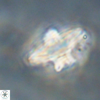 Discoaster diastypus VR 29110