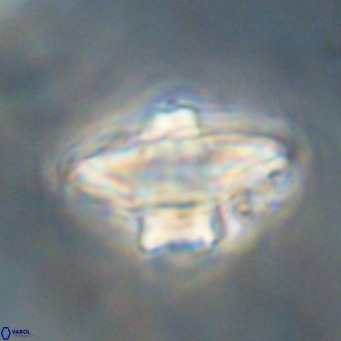 Discoaster diastypus VR 29111