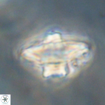 Discoaster diastypus VR 29111