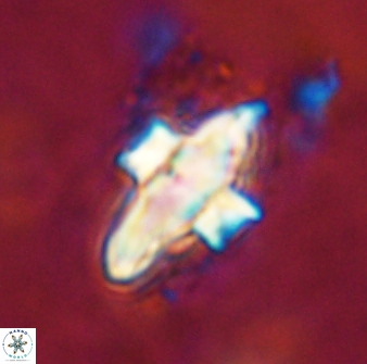 Discoaster disatypus 49402