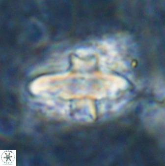 Discoaster disatypus 49410