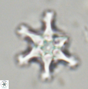 Discoaster diplasiastike 32515