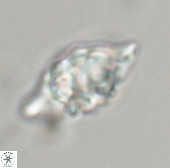 Discoaster diplasiastike 32521