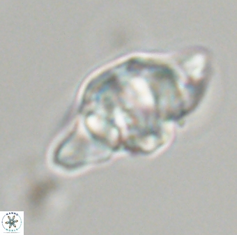 Discoaster diplasiastike 32522