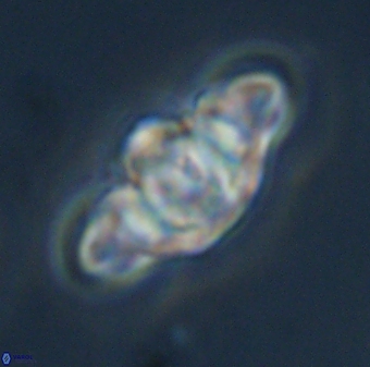 Discoaster diplasiastike 32532