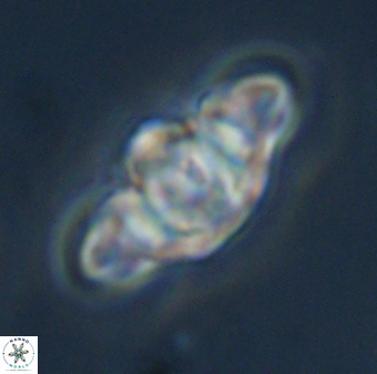 Discoaster diplasiastike 32532