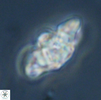 Discoaster diplasiastike 32533