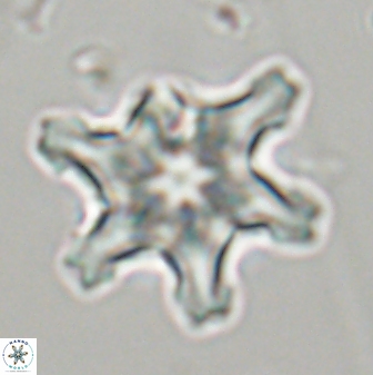 Discoaster diplasiastike 32544