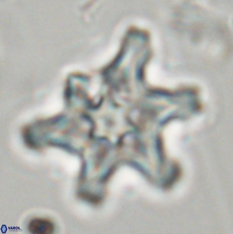 Discoaster diplasiastike 32546