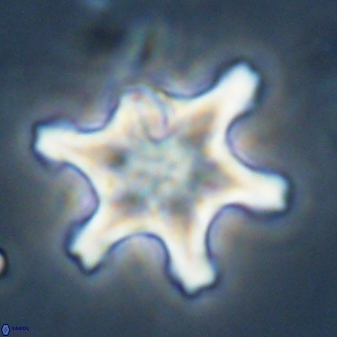 Discoaster diplasiastike 32551