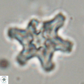 Discoaster diplasiastike 32554