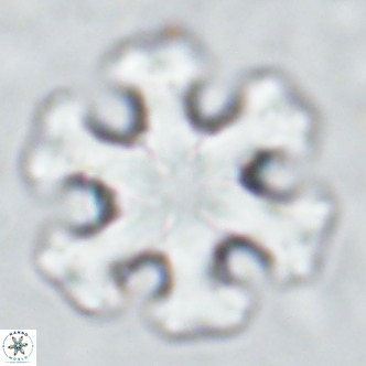 Discoaster emblematicus VR 17261