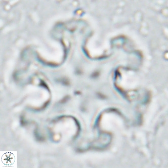 Discoaster emblematicus VR 17262
