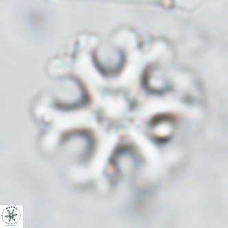 Discoaster emblematicus VR 17785