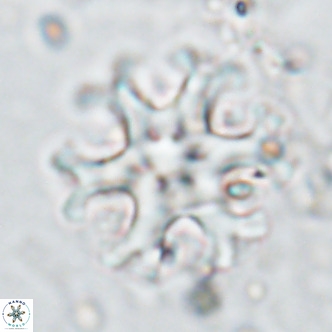 Discoaster emblematicus VR 17787