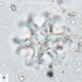 Discoaster emblematicus VR 17788