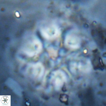 Discoaster emblematicus VR 17789