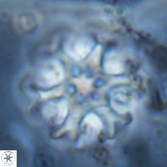 Discoaster emblematicus VR 17790