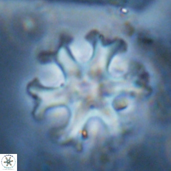 Discoaster emblematicus VR 17792