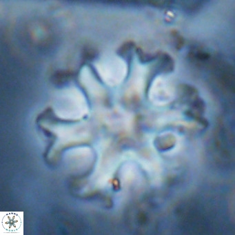 Discoaster emblematicus VR 17794