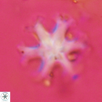Discoaster emblematicus VR 17795