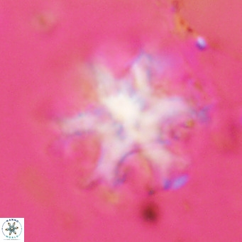 Discoaster emblematicus VR 17797
