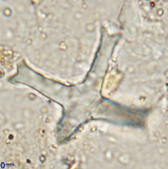Discoaster eminehinigazeae VR 025664