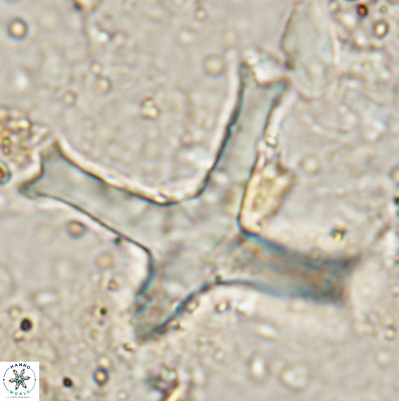 Discoaster eminehinigazeae VR 025664