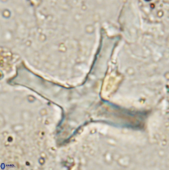 Discoaster eminehinigazeae VR 025664