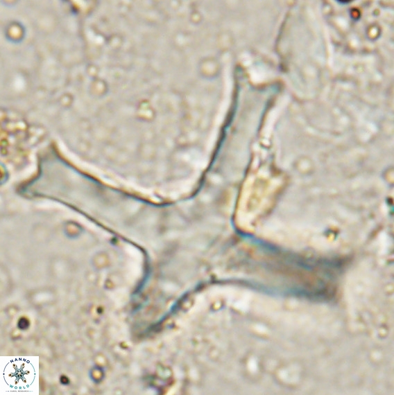 Discoaster eminehinigazeae VR 025664