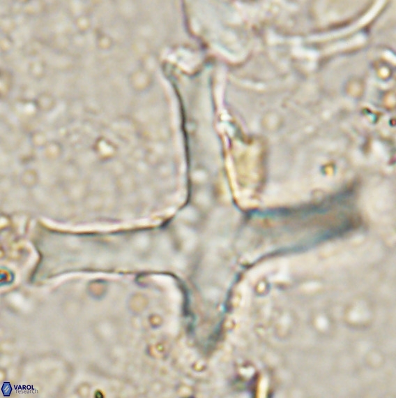 Discoaster eminehinigazeae VR 025665