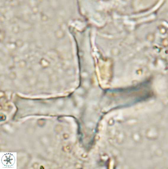Discoaster eminehinigazeae VR 025665