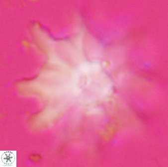 Discoaster falcatus 25138