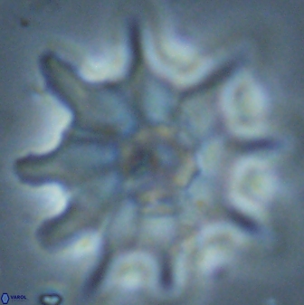 Discoaster falcatus 25144