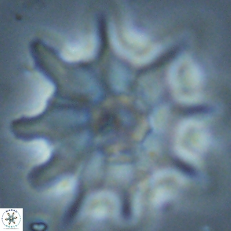 Discoaster falcatus 25144