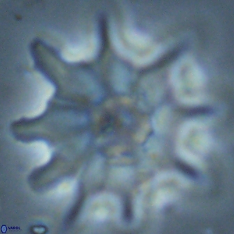 Discoaster falcatus 25145