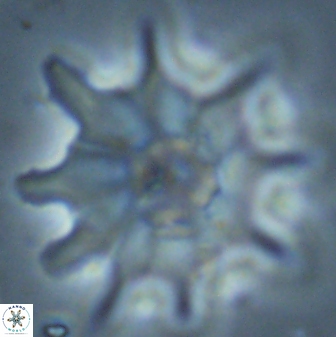 Discoaster falcatus 25145