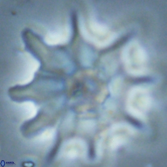 Discoaster falcatus 25146