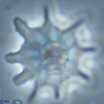 Discoaster falcatus 25147