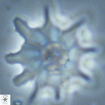 Discoaster falcatus 25147