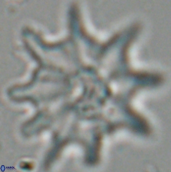 Discoaster falcatus 25140