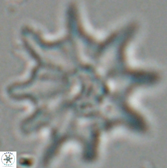 Discoaster falcatus 25140