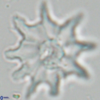 Discoaster falcatus 25143