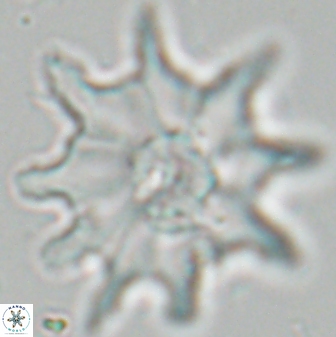 Discoaster falcatus 25143