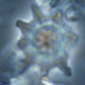 Discoaster falcatus 23319