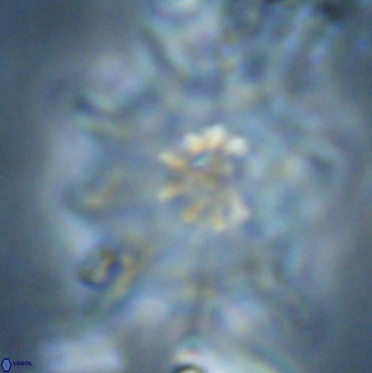 Discoaster falcatus 23320