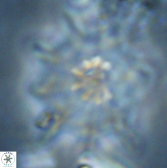 Discoaster falcatus 23320