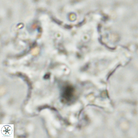 Discoaster falcatus 49435